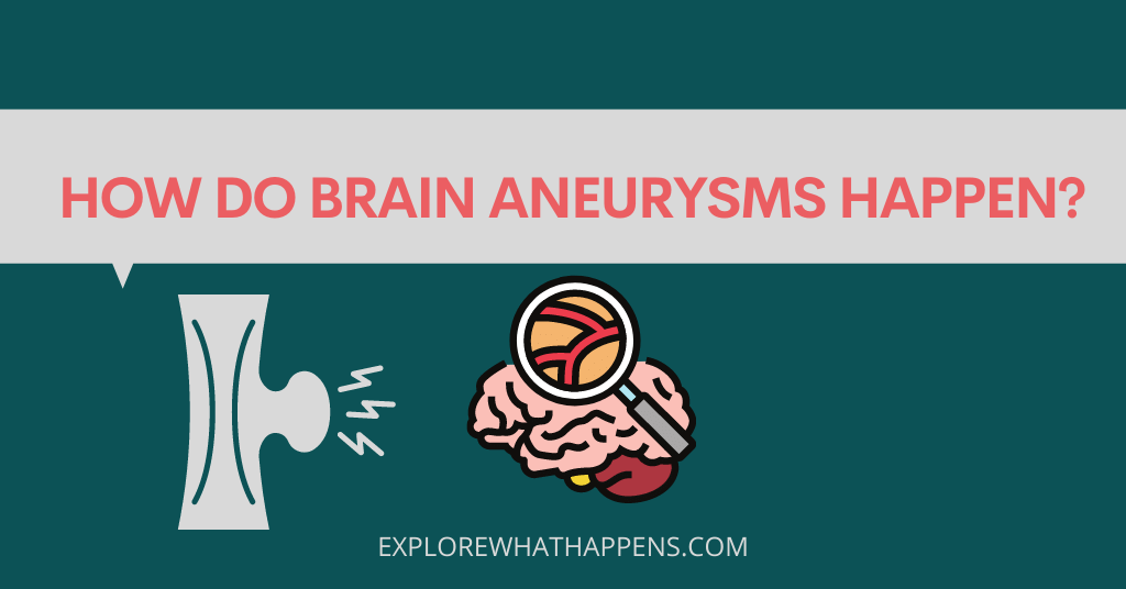 aneurysms